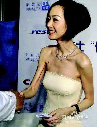 明星娱乐减肥,揭秘明星们的瘦身秘诀与健身之道