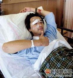 被火烧毁容的男明星,被火烧毁容男明星的勇敢蜕变之路